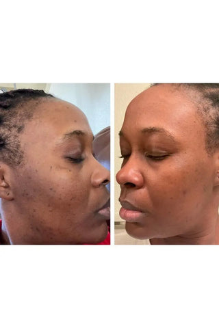 Charcoal Face Mask - Kandaka Safia