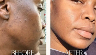 Charcoal Face Mask - Kandaka Safia