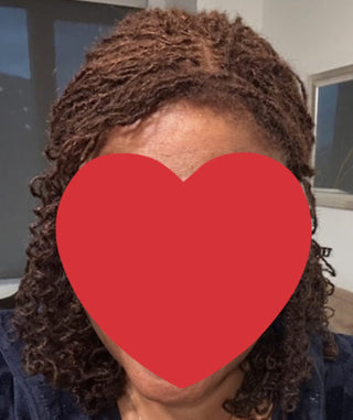 MICROLOCS TOPPER LOCSCCESSORY